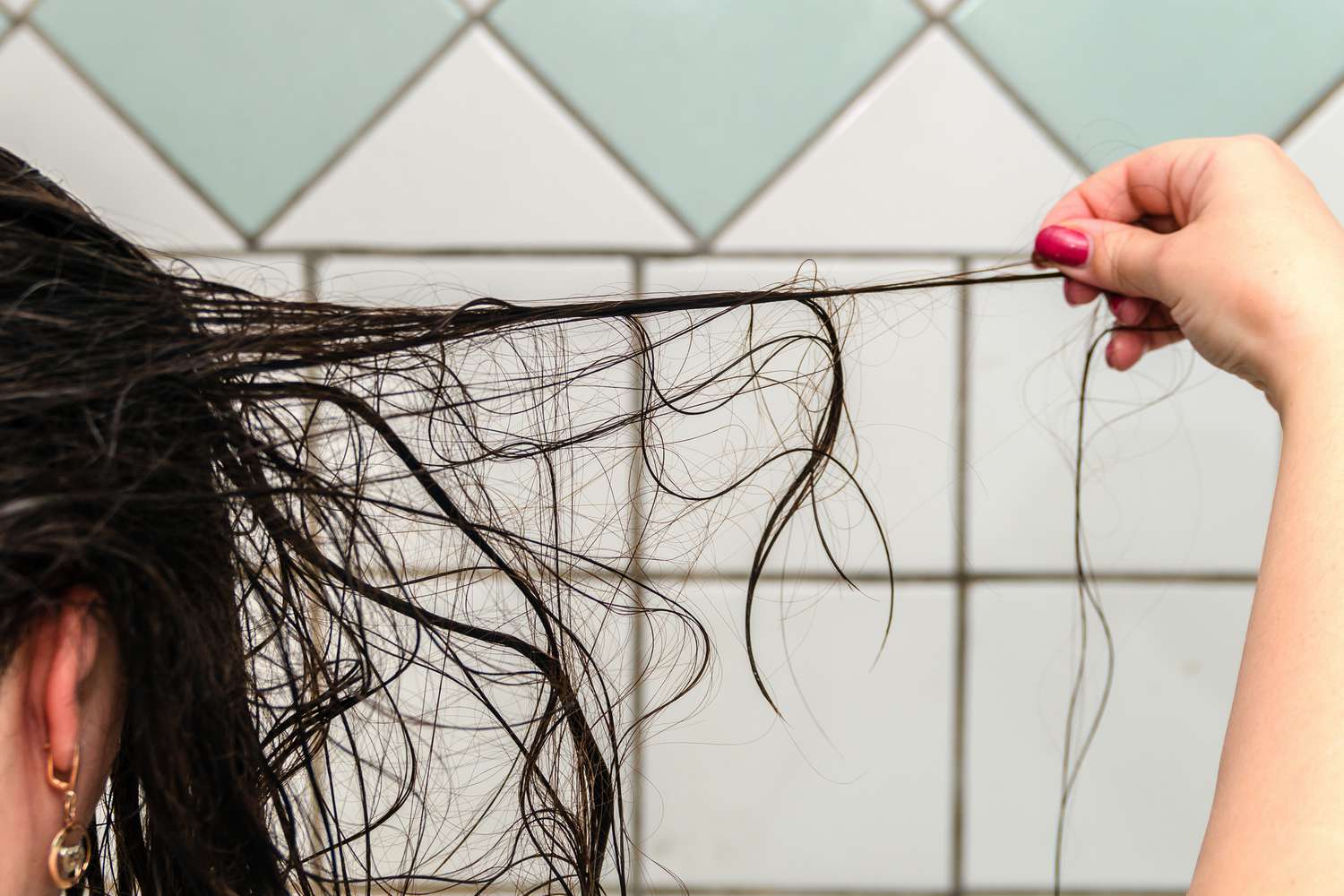Hair Fall: Causes, Treatment, and Prevention for Healthy Hair